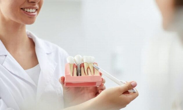 Dental Implants in Turkey: The Process and Materials Used