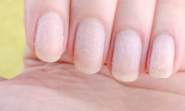 Vitamin B12 for nails: Is this nutrient good for nail growth?