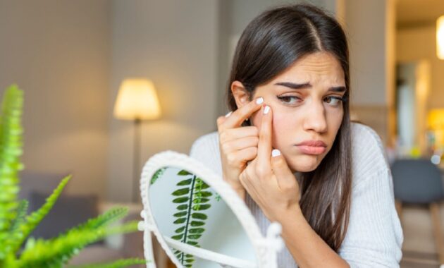 Effective home remedies to get rid of blackheads