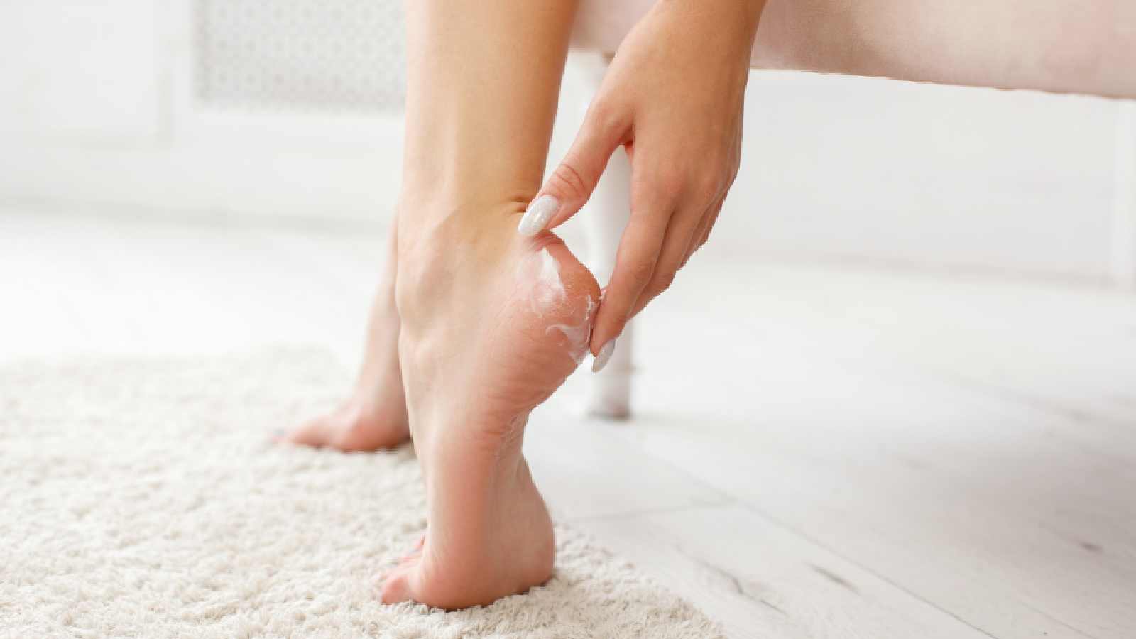 5 tips to heal cracked heels