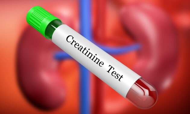 Diet tips to maintain healthy creatinine levels