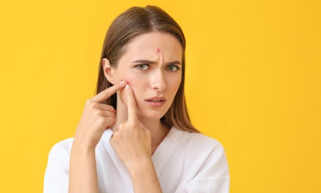 Acne: Types, symptoms, causes, treatment, prevention and more