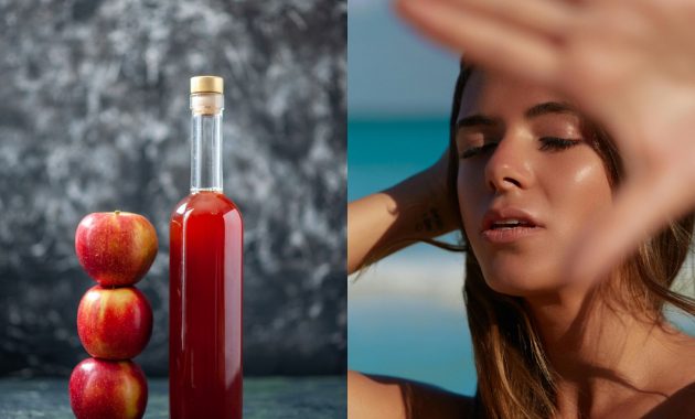 Apple cider vinegar: Is it a good home remedy for sunburn?