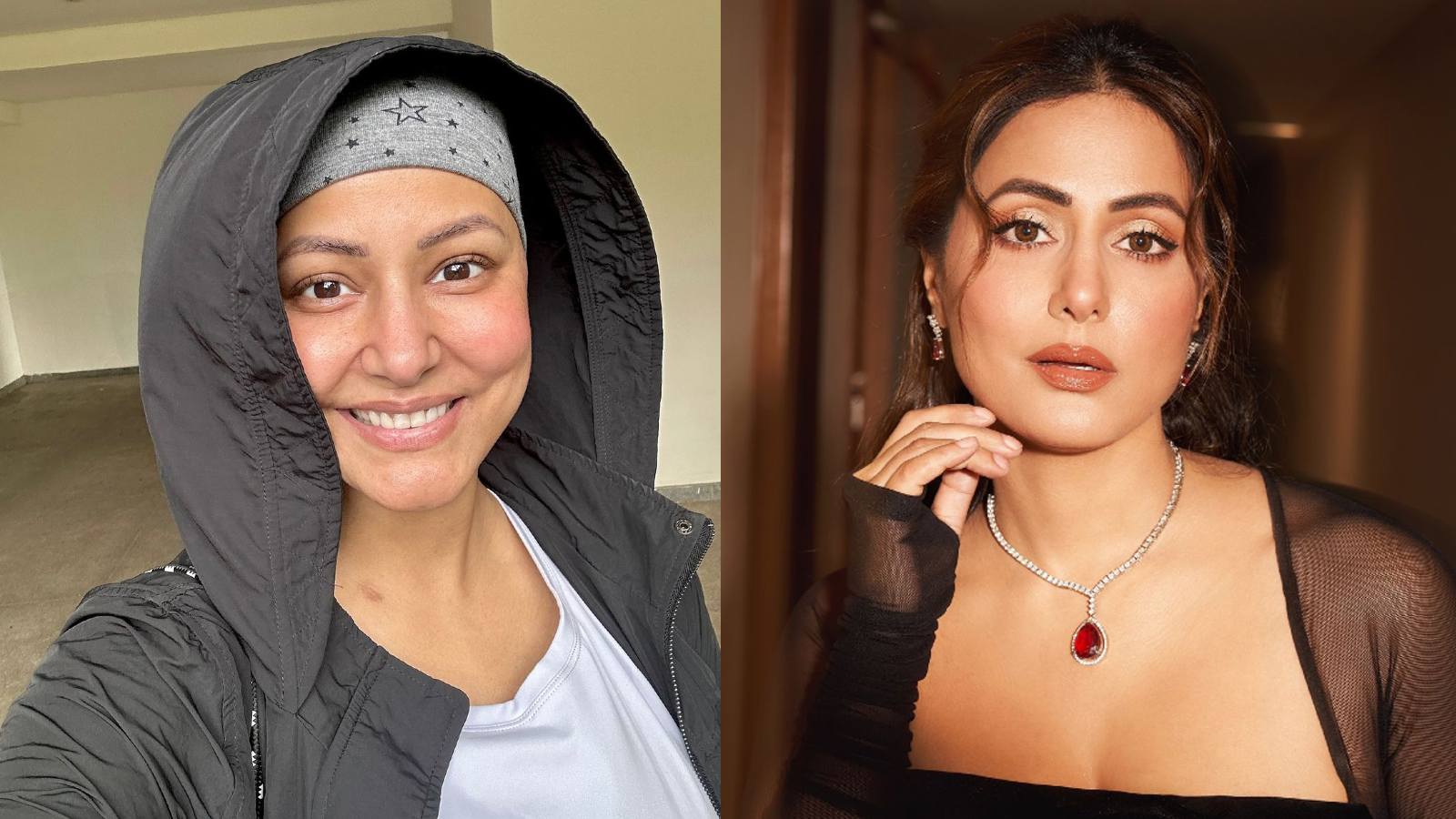 Hina Khan experiences eyelash loss as a side effect of chemotherapy