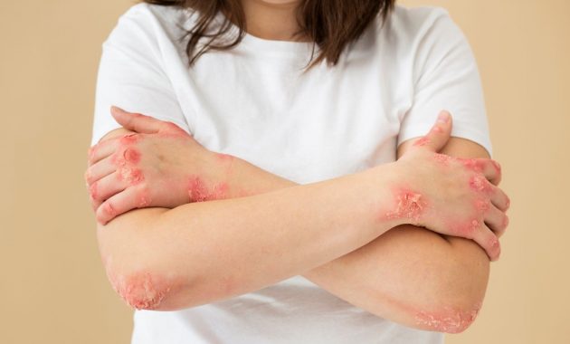 Red spots on skin: Know the causes and treatment